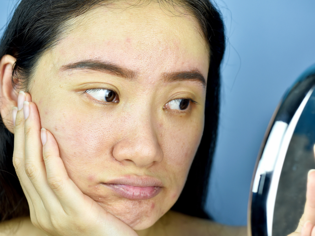 Poros dilatados y piel opaca: Cómo el Propóleo y la Niacinamida te darán el "Glow" definitivo