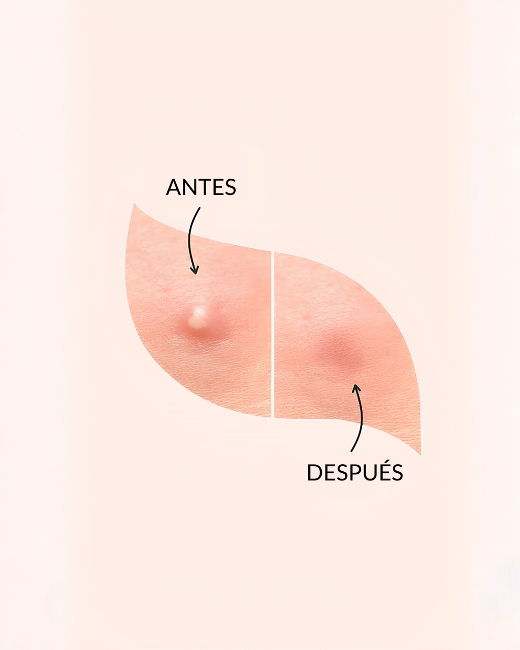 COSRX Acne Pimple Master Patch (24 Piezas - Parches Antiacné)